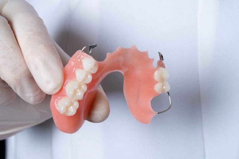 How Long Do Complete Dentures Last? North East