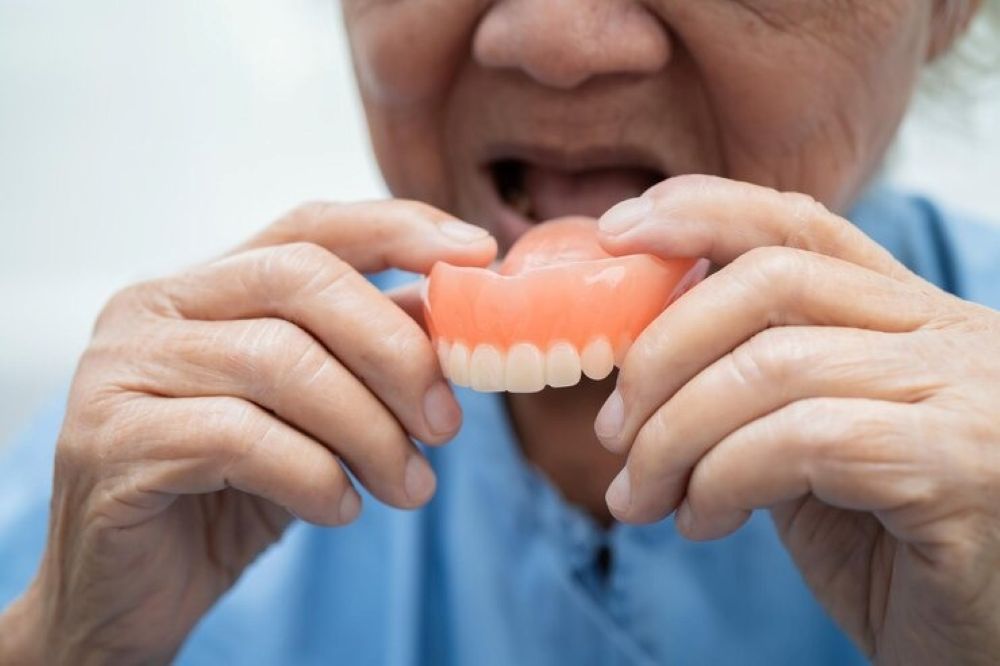 How Partial Dentures Are Made: A Step-by-Step Guide from Impression to Fitting