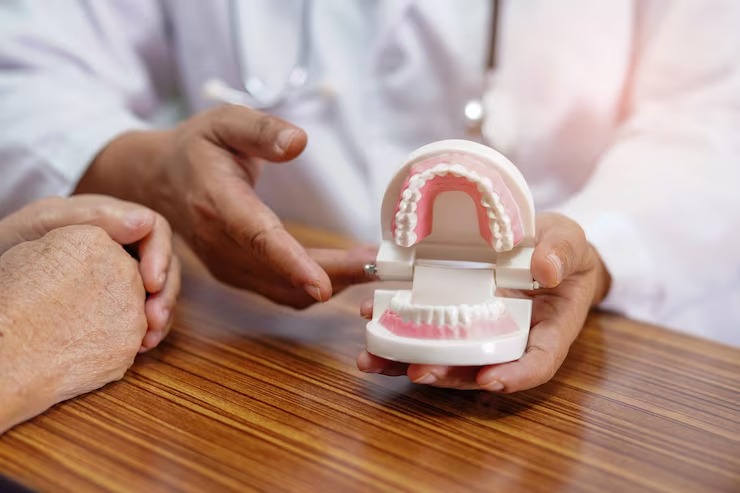 Custom dentures made in our on site lab what patients should know