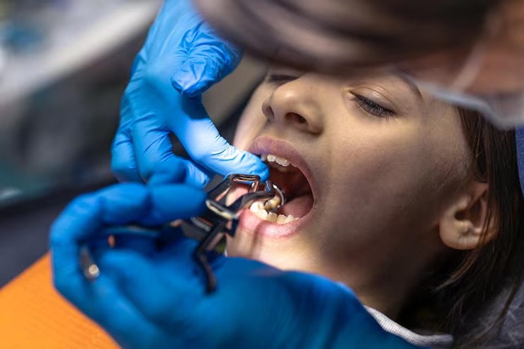 How to get used to wearing partial dentures